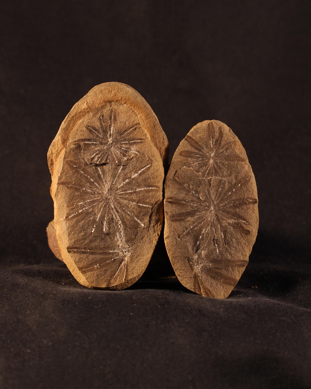 最新排石技術革新尿路結石治療方法，引領治療新潮流